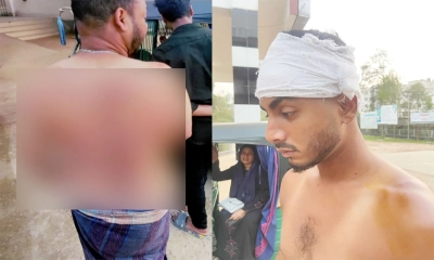 পর্তুগাল প্রবাসীর ওপর সন্ত্রাসী হামলা, মামলা তুলে নিতে হুমকি