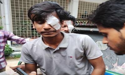 পুলিশের ছোঁড়া গুলিতে চোখ হারাতে বসেছে রাসেল রানা
