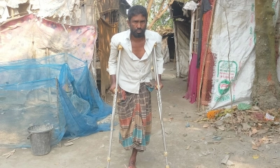 এক পা হারিয়ে আবুল হোসেনের মানবেতর জীবনযাপন