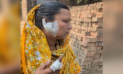 কুষ্টিয়ায় ছাগলে গম খাওয়াকে কেন্দ্র করে সংঘর্ষ, নারীসহ আহত ৪