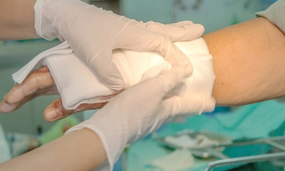 আগুনে পুড়ে গেলে করণীয়