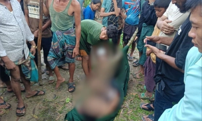 এবার সীমান্তে মাইন বিস্ফোরণে মায়ানমারের নাগরিকের পা বিচ্ছিন্ন