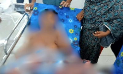 স্বামীর পুরুষাঙ্গ কাটলেন দ্বিতীয় স্ত্রী, হাসপাতালে নিলেন তৃতীয় স্ত্রী