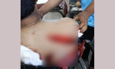 গাজীপুরে ব্যবসায়ীকে কুপিয়ে টাকা ও স্বর্ণালংকার ছিনতাই