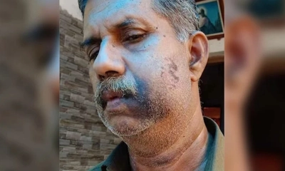 হামলার  শিকার ভি জে বাবু। ছবি: সংগৃহীত