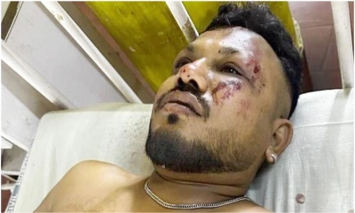 বিমান দুর্ঘটনায় বেঁচে গিয়েছেন এক যাত্রী। ছবি- সংগৃহীত