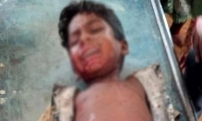 ককটেল বিস্ফোরণে আহত একই পরিবারের তিন শিশু