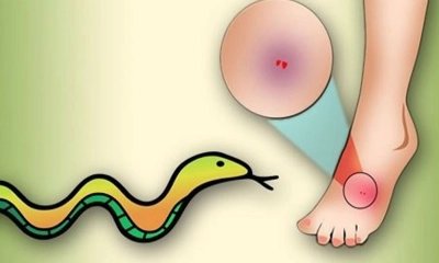 প্রতীকী  ছবি
