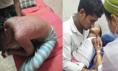 ভিমরুলের কামড়ে বাবা-মেয়ে ও ছেলের মৃত্যু