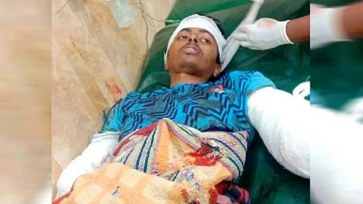 স্ত্রীর গোপন ভিডিও ধারণ, ভাইয়ের কবজি কাটলেন ভাই