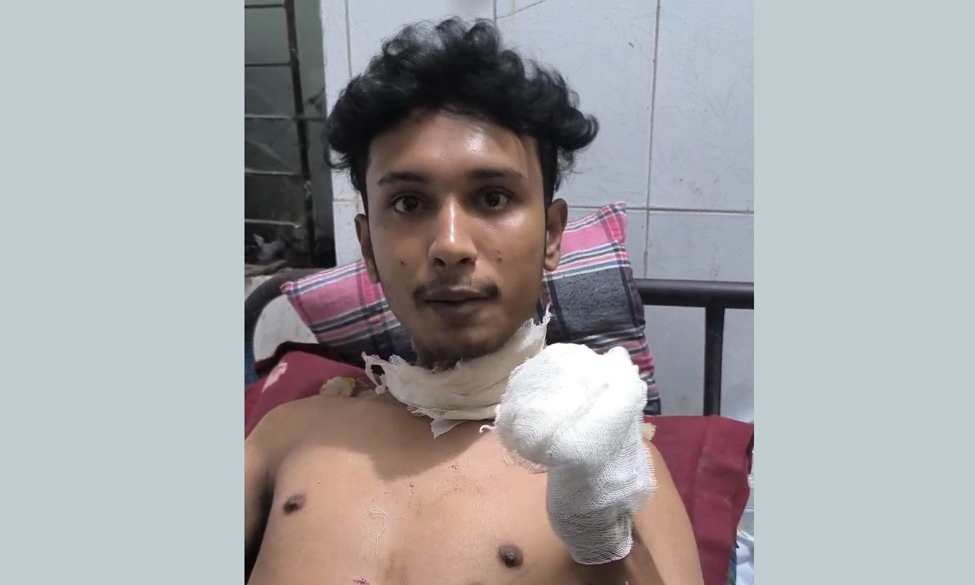 বন্ধুর ছুরিকাঘাতে বন্ধু আহত। ছবি- রূপালী বাংলাদেশ