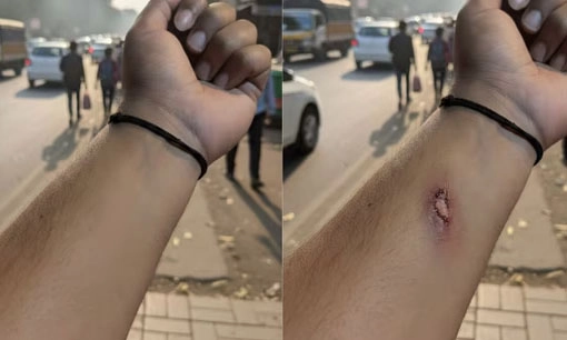 ছবি- সংগৃহীত