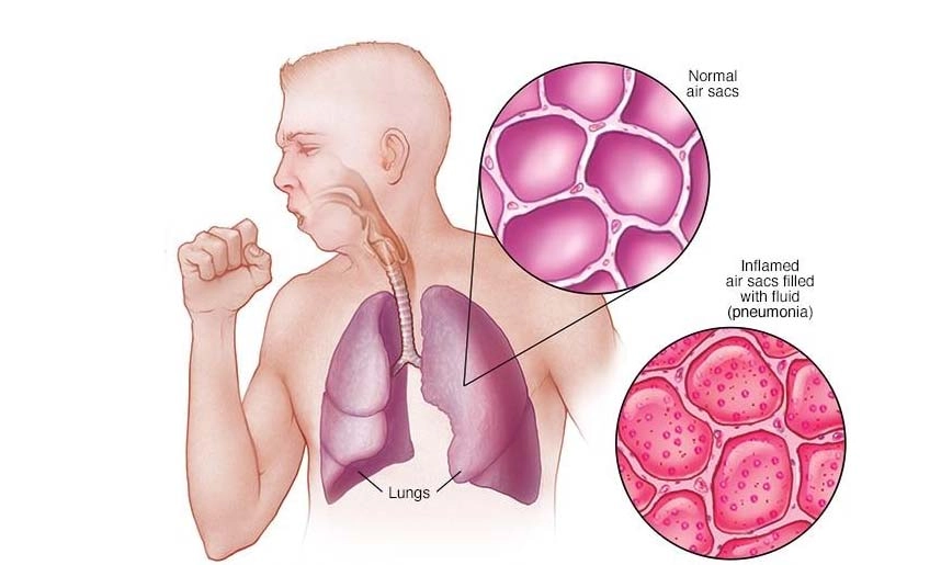 ছবি- সংগৃহীত