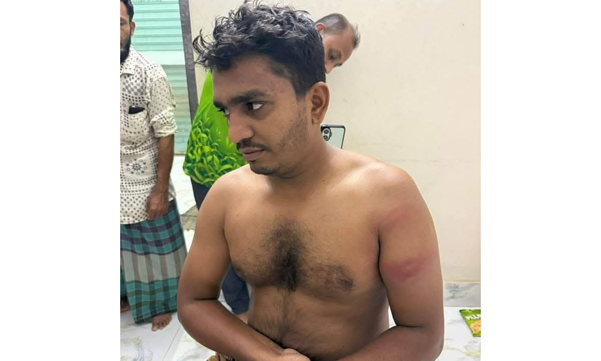 ​​ছাত্রলীগ-যুবলীগের হামলায় ছাত্রদল নেতা হাসপাতালে