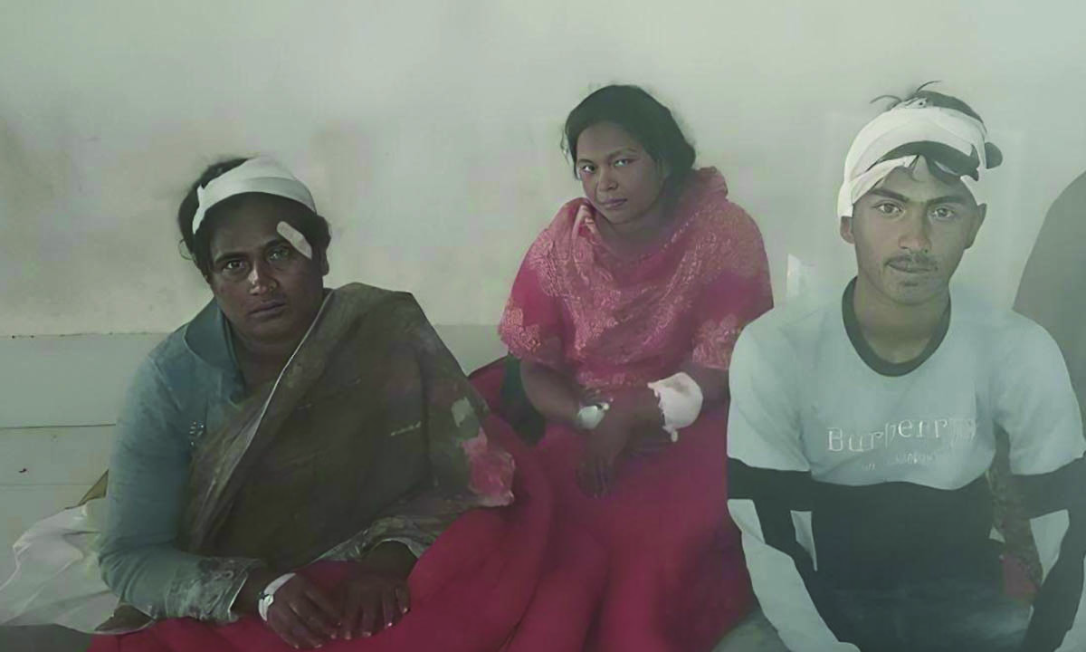 সংঘর্ষে আহতরা। ছবি : রূপালী বাংলাদেশ