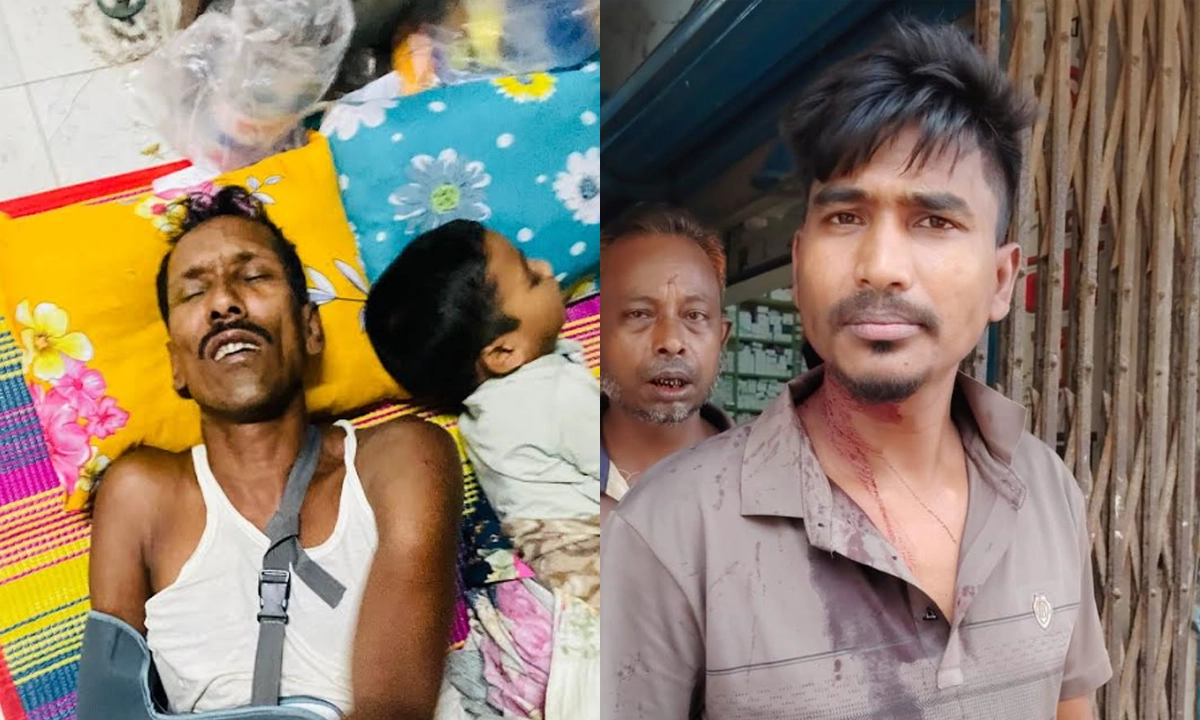 আহতরা। ছবি : রূপালী বাংলাদেশ