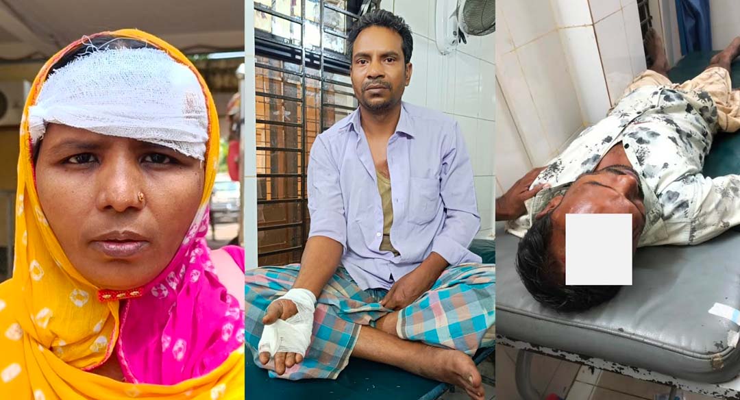 হামলায় আহতরা। ছবি : রূপালী বাংলাদেশ