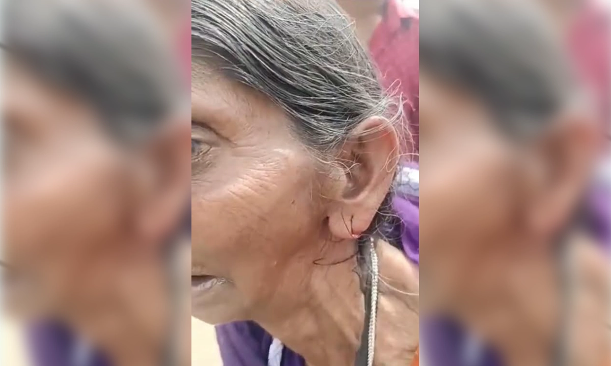 ভিক্ষুকের কান ও নাক ছিড়েনিয়ে যায় স্বর্ণালংকার। ছবি : রূপালী বাংলাদেশ