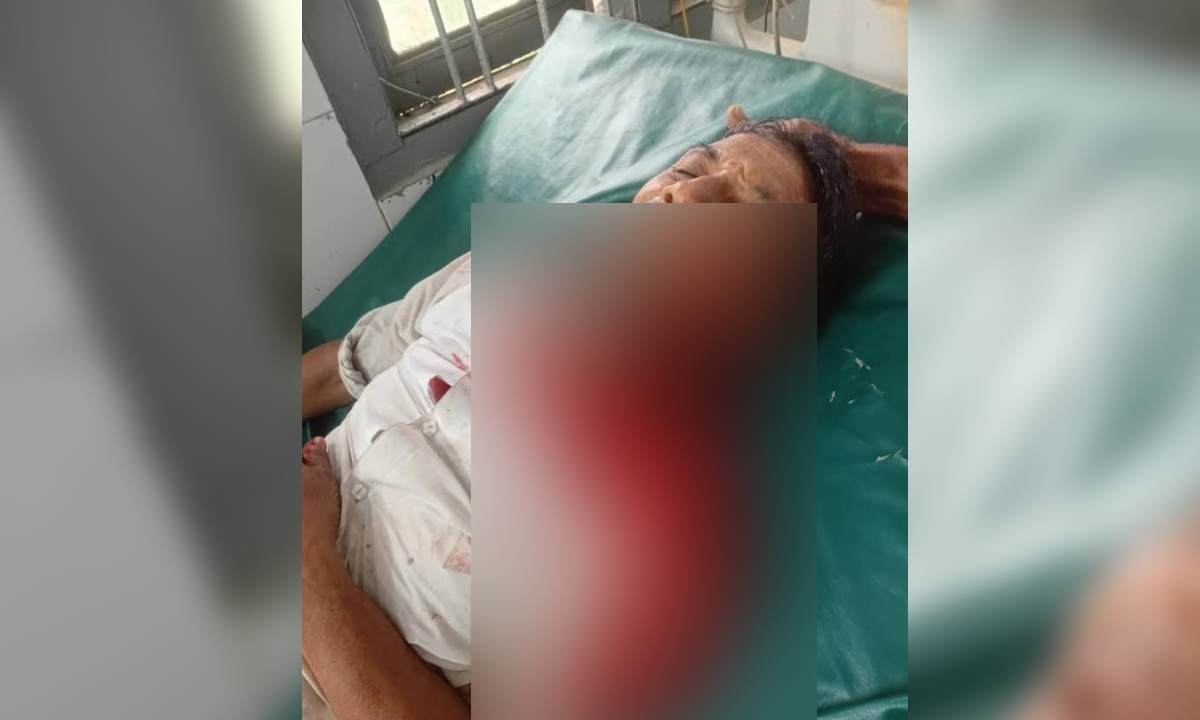 গুলিবিদ্ধ ছৈয়দ আলমকে হাসপাতালে নিয়ে আসা হয়েছে। ছবি : রূপালী বাংলাদেশ