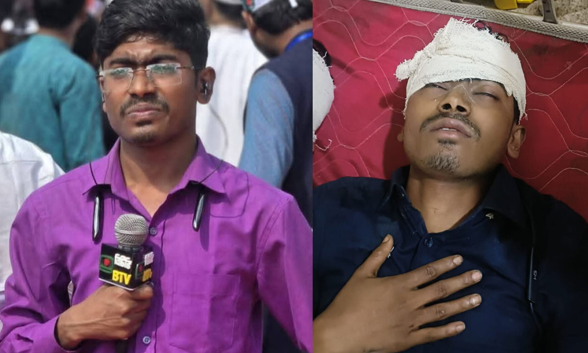 আহত সাংবাদিক মিরাজ উদ্দিন। ছবি : রূপালী বাংলাদেশ