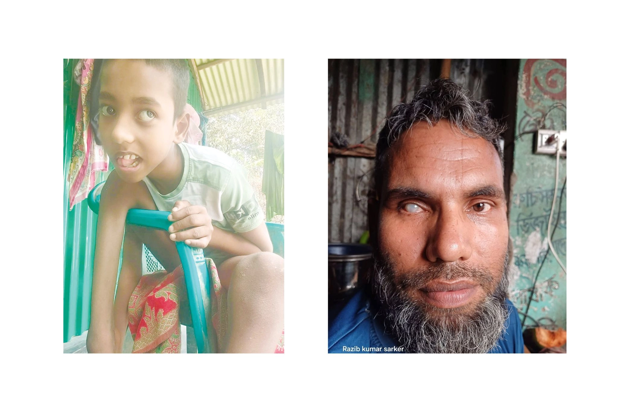 প্রতিবন্ধী বাবা-ছেলের ভাগ্যে  জোটেনি ভাতার কার্ড