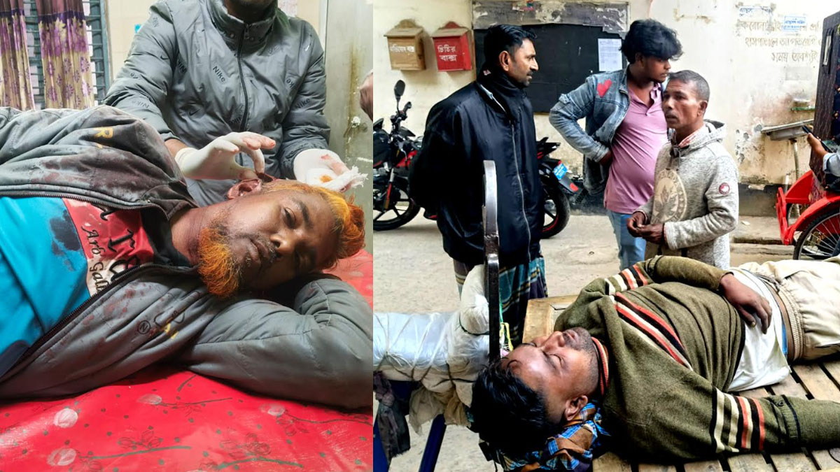 আহতদের হাসপাতালে নিয়ে আসা হয়েছে। ছবি : রূপালী বাংলাদেশ