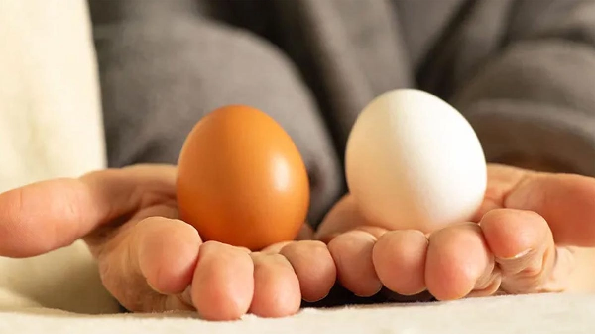 ছবি- সংগৃহীত