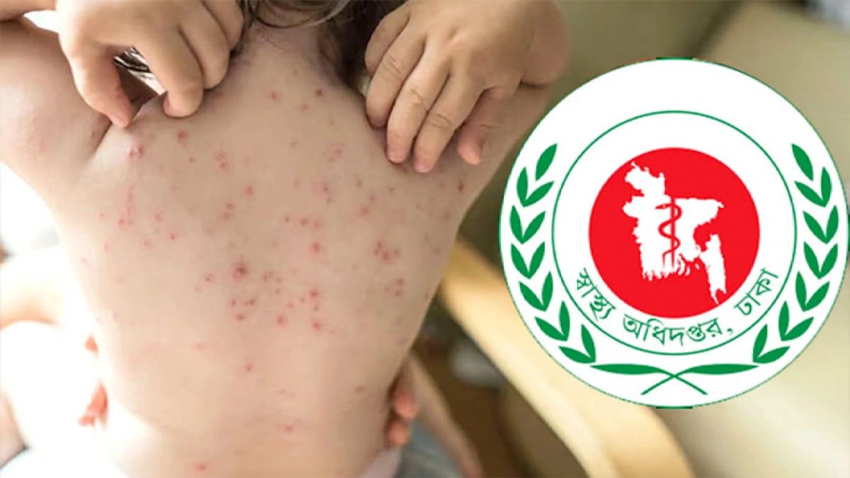 স্বাস্থ্য অধিদপ্তর। ছবি : সংগৃহীত