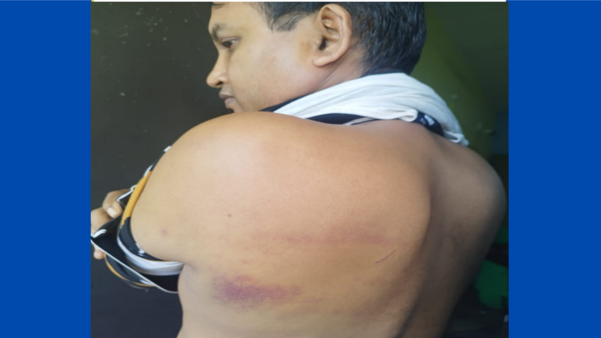 আহত শিক্ষক। ছবি- রূপালী বাংলাদেশ