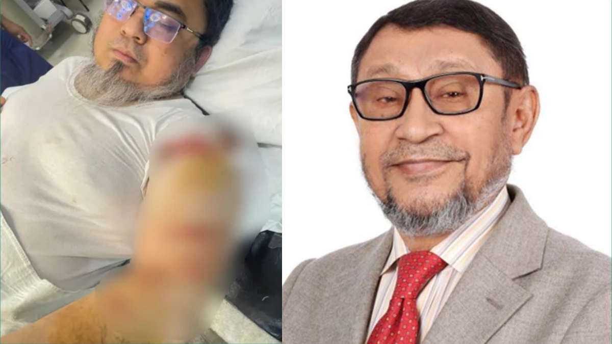 আহত চিকিৎসক আহমেদ হোসেন ও স্বাস্থ্য ও পরিবার কল্যাণমন্ত্রী সরদার মো. সাখাওয়াত হোসেন। ছবি- সংগৃহীত