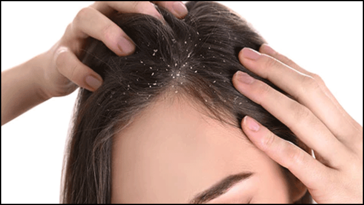 প্রতীকী ছবি।