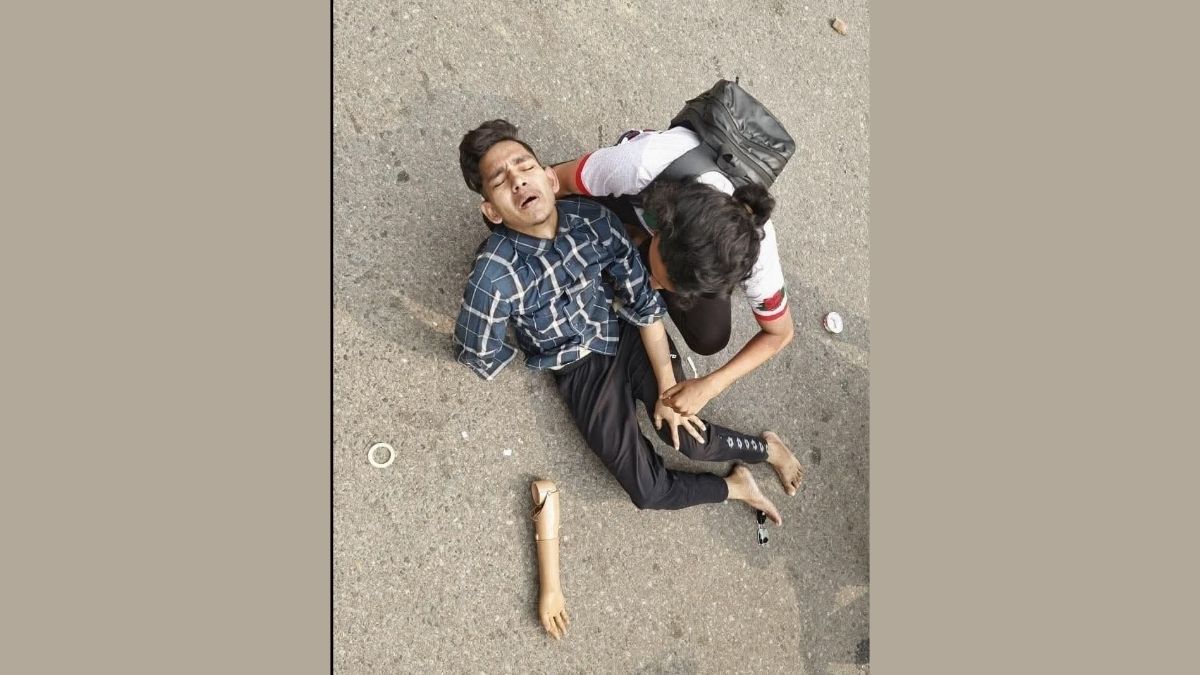 আহত জুলাই যোদ্ধা। ছবি- সংগৃহীত