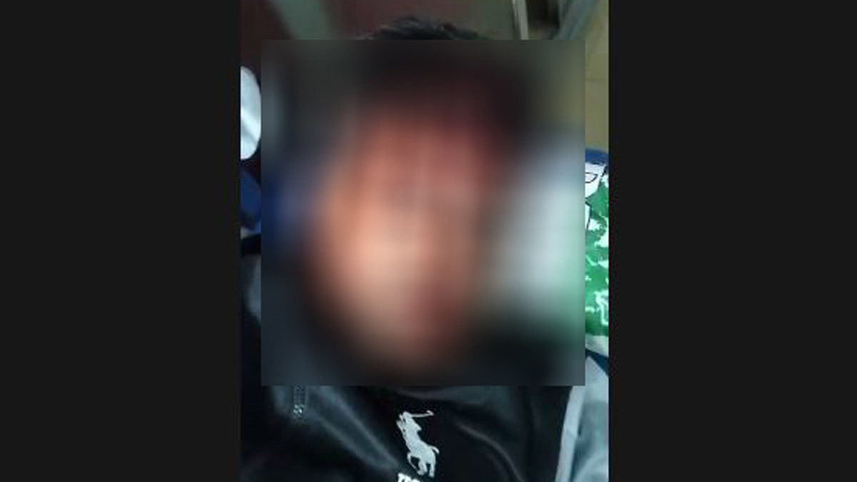 আহত ব্যক্তি। ছবি- সংগৃহীত