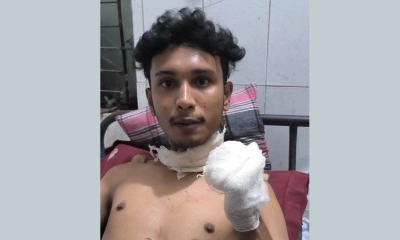 বন্ধুর ছুরিকাঘাতে বন্ধু আহত। ছবি- রূপালী বাংলাদেশ