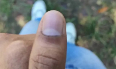 ‘অমোচনীয়’ কালি মুছে যাওয়ার অভিযোগ