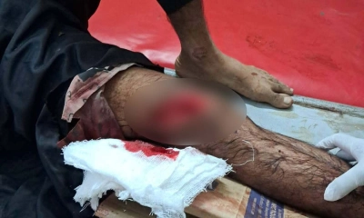 বনকর্মীদের ওপর চোরাকারবারিদের বর্বর হামলায় আহত ২