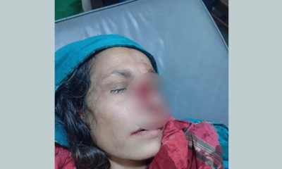 প্রতিবেশীর হামলায় নাক হারালেন নারী