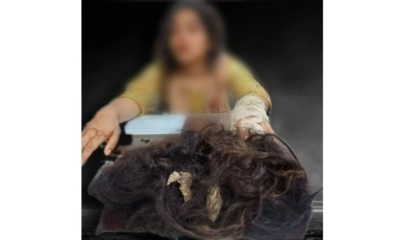 কাটা চুল ও রক্তাক্ত শরীর নিয়ে থানায় হাজির গৃহবধূ, নির্যাতনের অভিযোগ