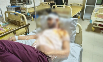 টুঙ্গিপাড়ায় বিএনপির কর্মীকে কুপিয়ে জখম