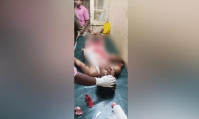 আর্জেন্টিনা-মিশর ম্যাচ ঘিরে বাগবিতণ্ডা, ব্রাজিল সমর্থকের নাক ফাটাল আর্জেন্টিনা সমর্থক