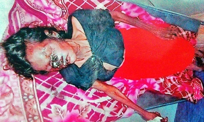 মৃত মহিলার পরিচয় শনাক্তে সহায়তা চায় শাহবাগ থানা পুলিশ