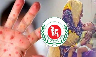 হাম উপসর্গে একদিনে ১১ শিশুর মৃত্যু, বেশি চট্টগ্রামে