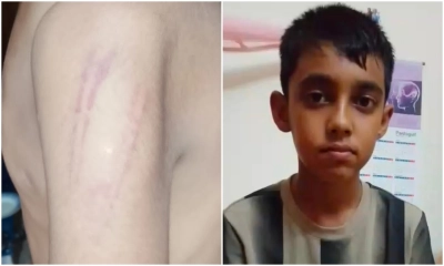 গান গাইতে না পারায় শিক্ষার্থীকে বেধড়ক পেটালেন শিক্ষক