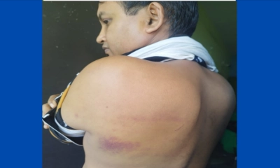 আহত শিক্ষক। ছবি- রূপালী বাংলাদেশ আহত শিক্ষক। ছবি- রূপালী বাংলাদেশ