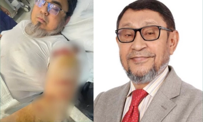 আহত চিকিৎসককে দেখতে হাসপাতালে স্বাস্থ্যমন্ত্রী