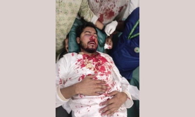 জাপা কার্যালয়ের সামনে ফের সংঘর্ষ, গুরুতর আহত নুর