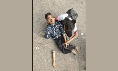 আহত জুলাই যোদ্ধার পাশে পড়ে ছিল তার কৃত্রিম হাত