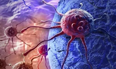 যেভাবে বুঝবেন ক্যানসার রোগের লক্ষণ