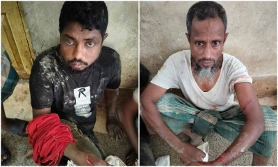তুচ্ছ ঘটনায় দুই ভাইকে হত্যাচেষ্টা। ছবি- রূপালী বাংলাদেশ