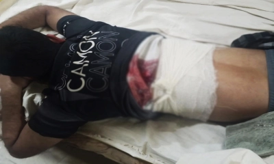 গুলিতে আহত মোবাইল ব্যবসায়ী।  ছবি: রূপালী বাংলাদেশ